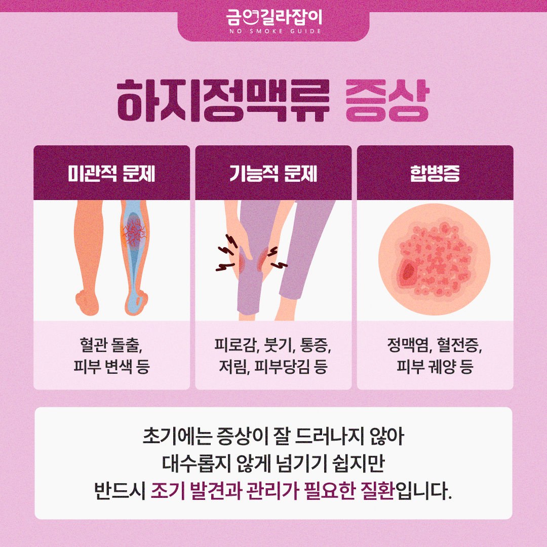 [카드뉴스] 울퉁불퉁한 다리 하지정맥류 원인 흡연 4