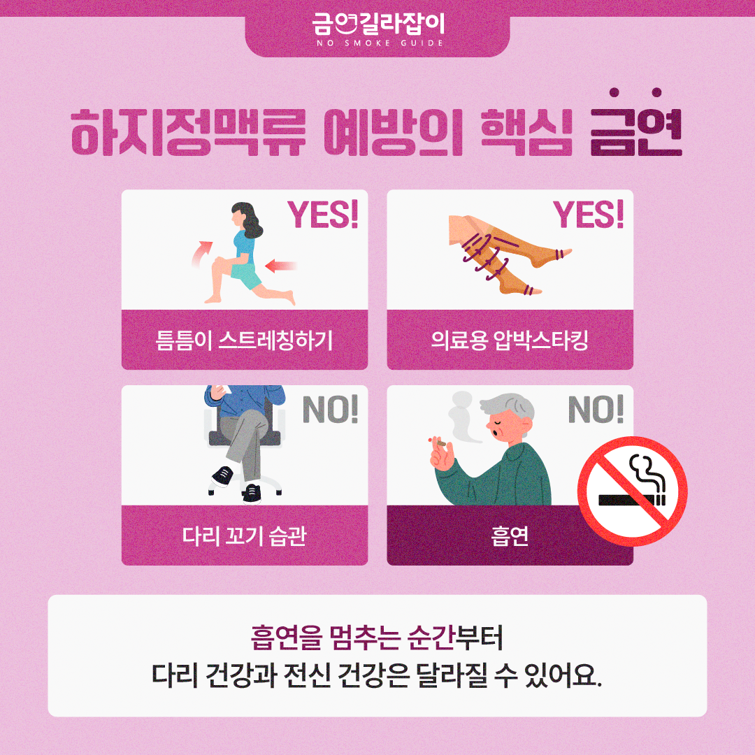 [카드뉴스] 울퉁불퉁한 다리 하지정맥류 원인 흡연 5